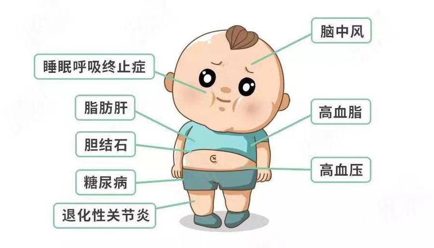 3,易诱发脂肪肝 重度肥胖儿童脂肪肝发病率高达80%,儿童肥胖是诱发