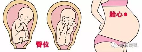 产检必须要懂的:胎心,宫高,腹围