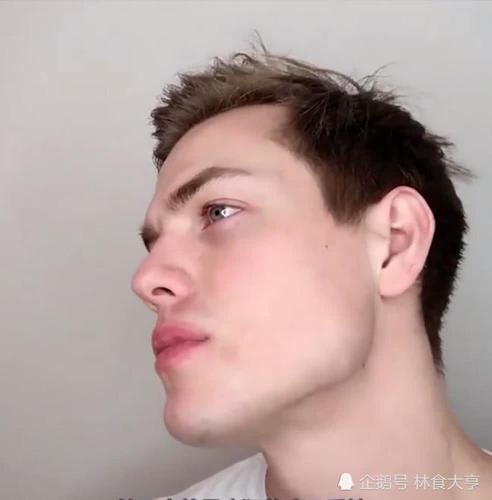 老外挑战嚼口香糖30天,对比之前的照片,这是做整容手术了么?