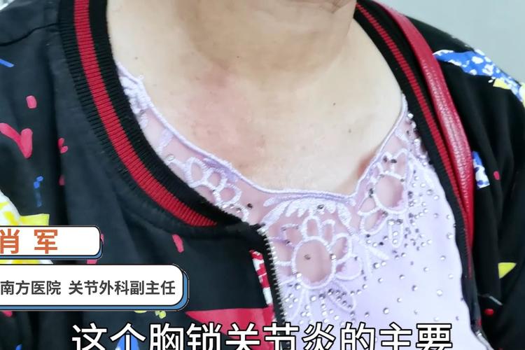 胸锁关节炎是怎么回事?怎么治好得快?一个视频说明白