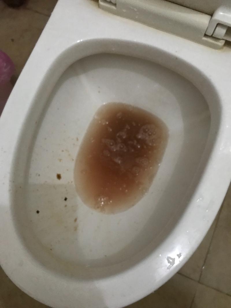 呕吐物这个颜色正常吗