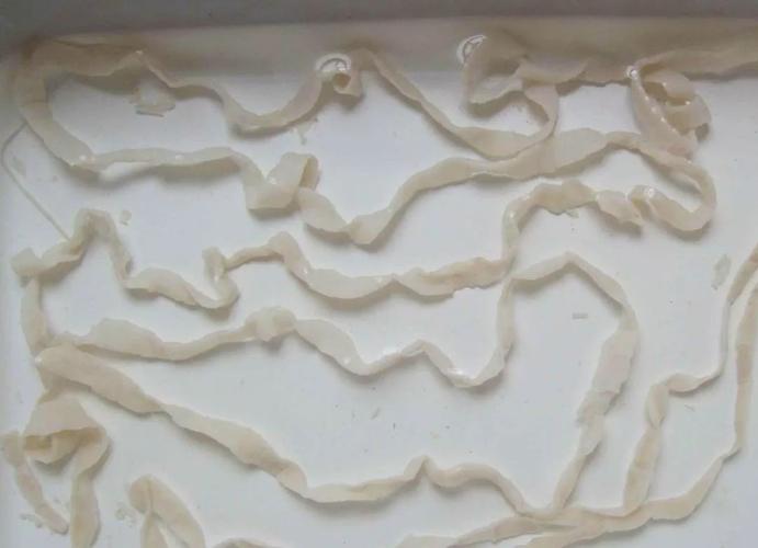 此外还有颚口线虫,绦虫,它们就是那类不安分,会乱跑的寄生虫.