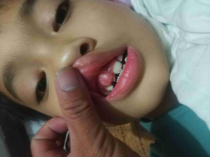 中间还像是一个肉疙瘩什么的.需要怎么处理?