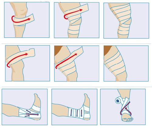 医用弹性绷带 骨折包扎固定运动防护 护腕护腿护脚踝护腰瘦身加压