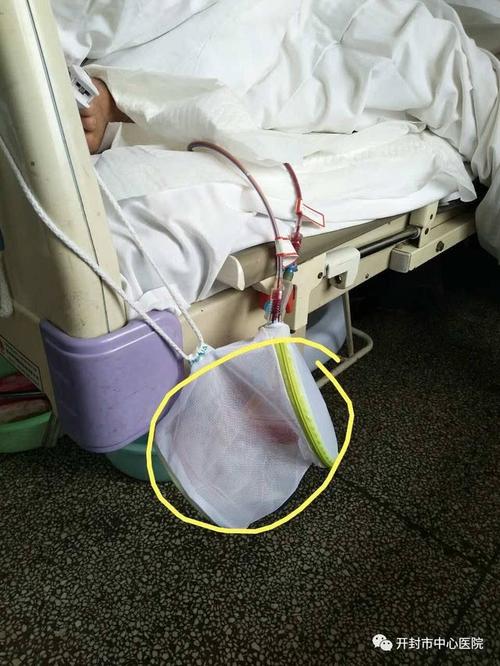 【病房故事】护士的小发明,细节体现人文关怀