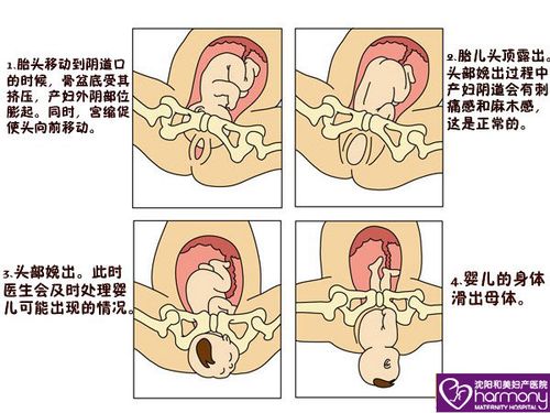 第三产程(胎盘娩出期)