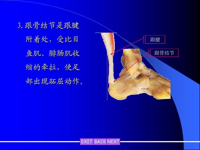 跟骨结节是跟腱 3.