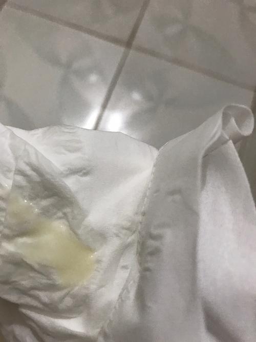 白带拉丝是因为宫颈粘液分泌到一定的量,为排卵做好准备,所以,白带