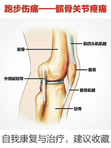 【建议收藏】跑步伤痛|髌骨关节疼痛_跑步_关节疼痛_跑鞋_运动_鞋子