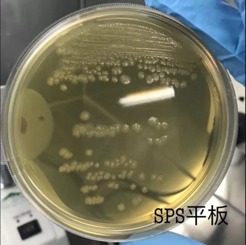 一次关于利用产气荚膜梭菌进行2个国标检测的方法证实