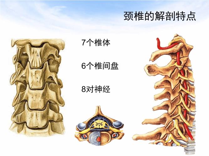 颈椎病的ct诊断