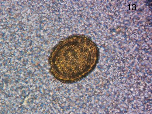 寄生虫虫卵图片