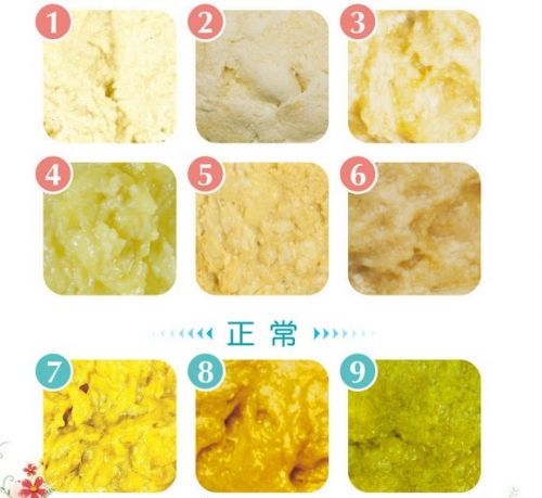 宝宝的便便怎么是这样的?正常吗?