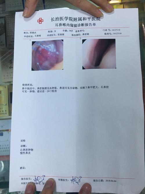 鼻子里面长了一块肉鼻镜和ct都做了,ct还没有让医生看