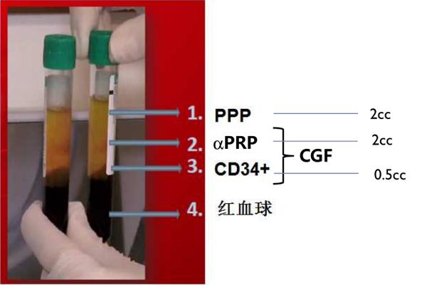 而生长因子的一个重要来源就是血液.   其次:利用意大利分离设备现场
