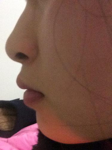 我嘴巴是尖的,往外凸,很丑,这是我牙齿的问题,还是我嘴巴本来就这样长