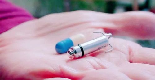 无导线起搏器体积仅1 cm,重量1.