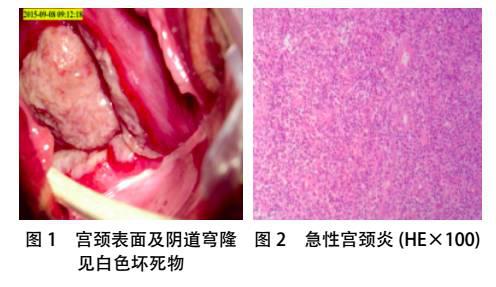 宫颈受累的白塞氏病二例
