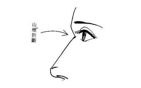 女性山根折断夫缘不佳(图片来源于作者博客)