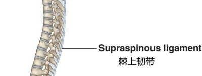 请小心脊柱中间的痛点脊柱棘上韧带炎