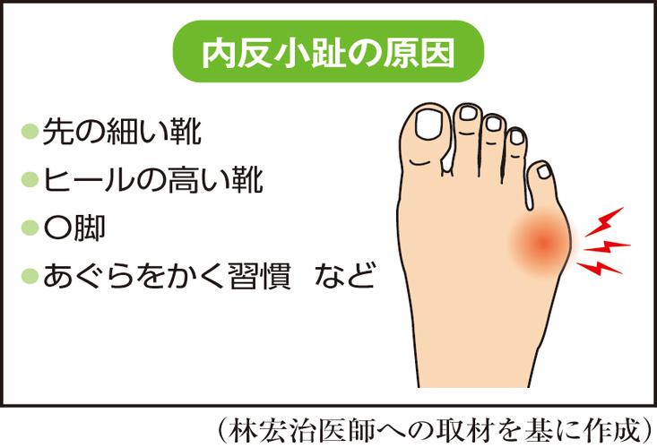 为什么走路时小脚趾会痛