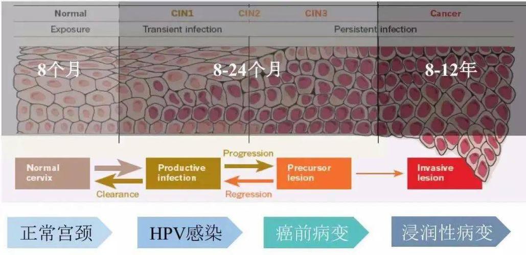即使是宫颈癌最开始的一期状态,  治愈率可以达到80%到90%,但发展到四