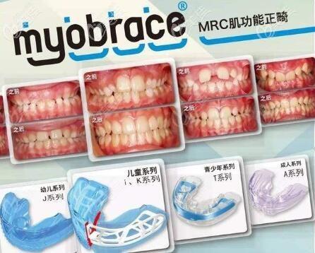 mrc早期干预矫正