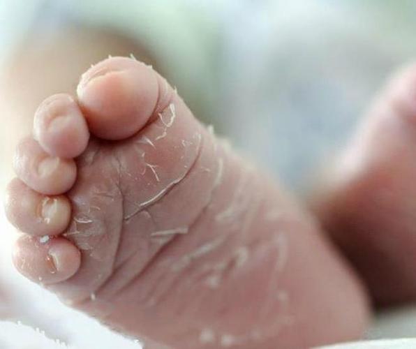 新生宝宝为什么会脱皮?应对宝宝脱皮,只需这4个小妙招!