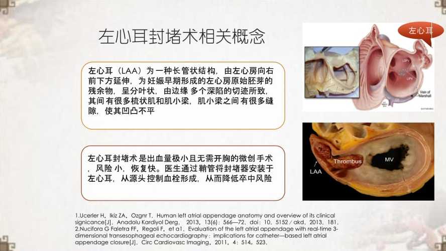 左心耳封堵术患者的相关知识点及护理查房ppt医学课件