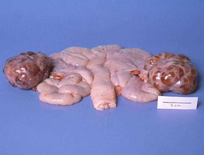 两侧有多个卵泡的母猪子宫和卵巢情况