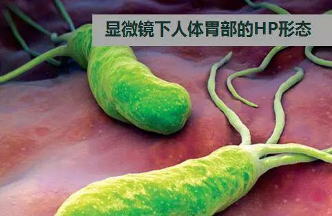 幽门螺杆菌天敌!