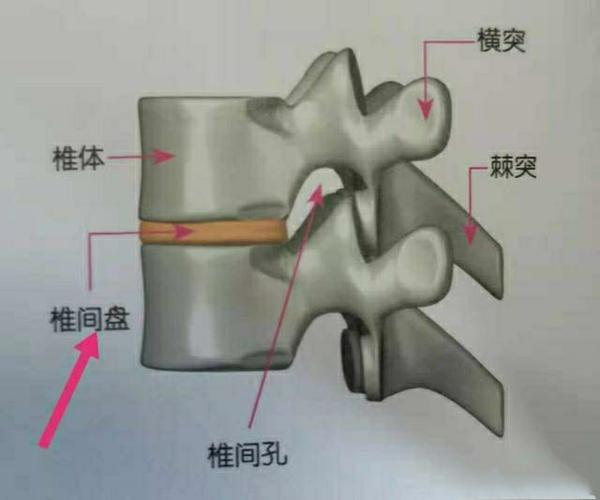 腰椎l3-4膨出,l4-5突出,l5-s1脱出是什么意思?