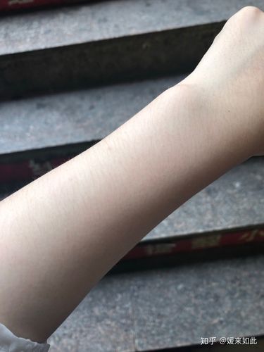 最难受的是皮肤白,胳膊汗毛多,在门口随手拍的一张图
