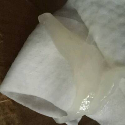 怀孕40 3 刚才流出一条大果冻 吓到宝宝了,怀孕以来内裤都是乾乾净净
