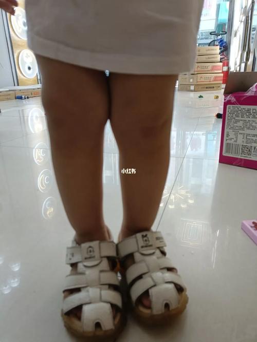 这是不是xo型腿好害怕_腿型_xo型腿_生活记录_接地气