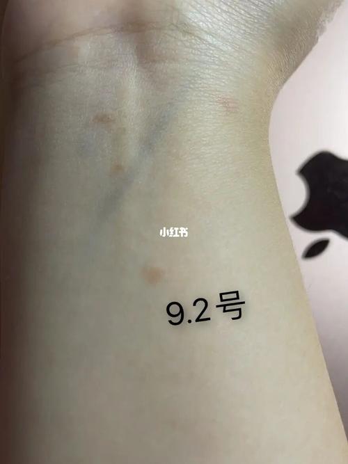 玫瑰糠疹痊愈过程96拒绝焦虑_焦虑_免疫力_钙片_痱子_维生素c_论文