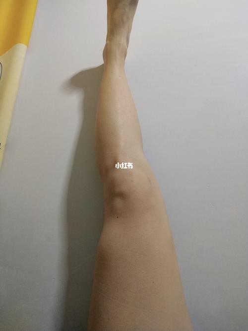 这腿弯的_腿型_医疗健康_医疗健康其他