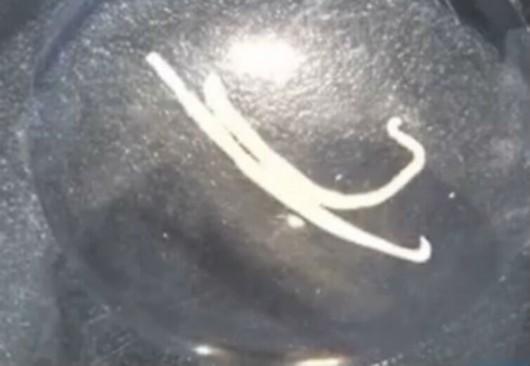 记者求证"黄鳝有致命寄生虫" 专家:对人不构成威胁