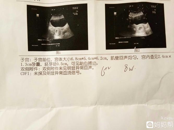 目前怀孕八周了,就六周的时候去做了个b超,其他什么检查都没做.