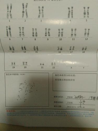 羊水穿刺检查,发现15号染色体微重复,怎么办?急!急!急