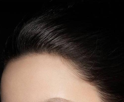 杭州发际线调整一般要注意哪几点