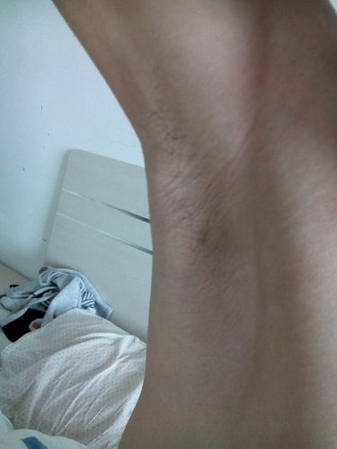 男腋毛长这么些,还能长个吗,你们多大腋毛是长这么些的?