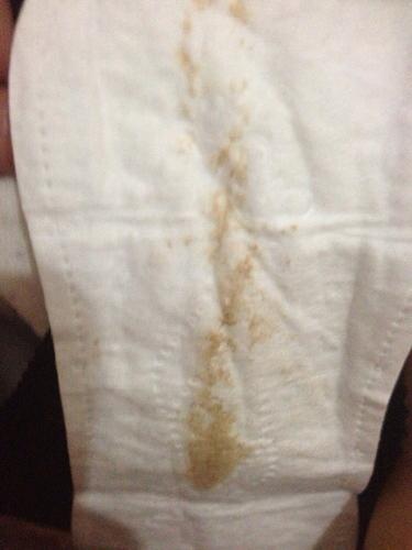 无痛人流后前些天没出血,半个月后有一点点血,颜色很暗,有什么问题吗?