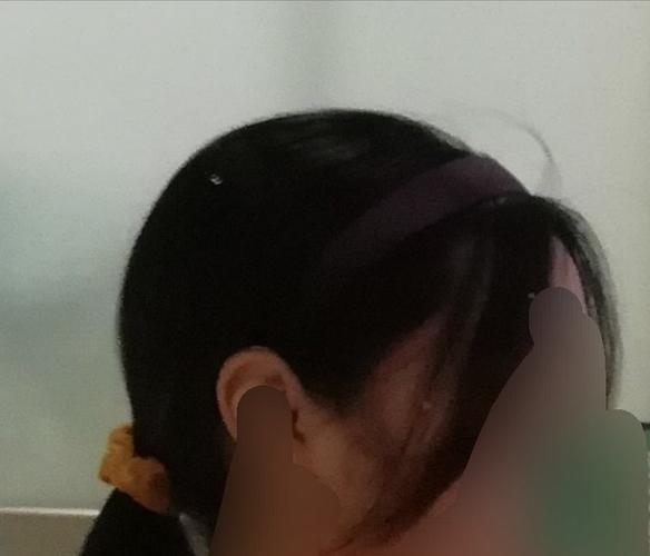 姐妹能不能帮我看看是不是高颅顶啊