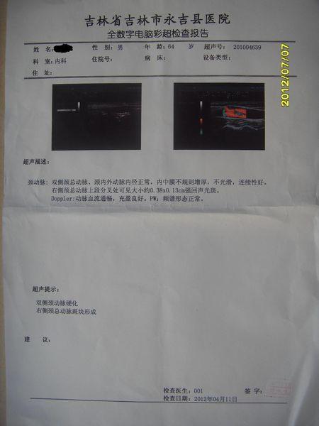颈部动脉彩超报告,求高人帮忙看一下严重吗?谢谢