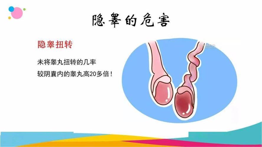 【唯爱儿科行 · 科普月月讲】儿童隐睾——迷失的"蛋蛋"