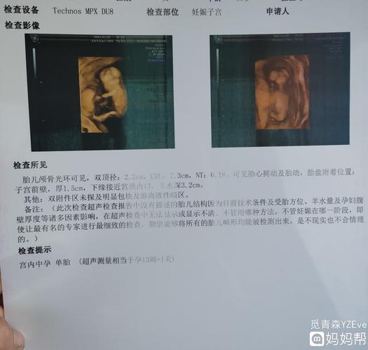 nt018是男孩还是女孩呢能