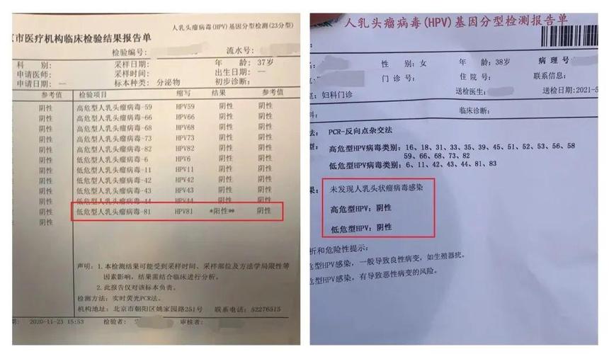 感染hpv我该怎么办刘文华院长提升正气是关键