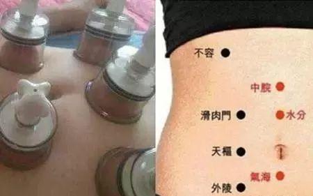 拔罐减肚子拔哪里图解 教你几种瘦身方式