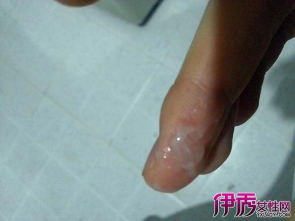 【图】健康常识乳白色白带图片 不能忽视的小现象